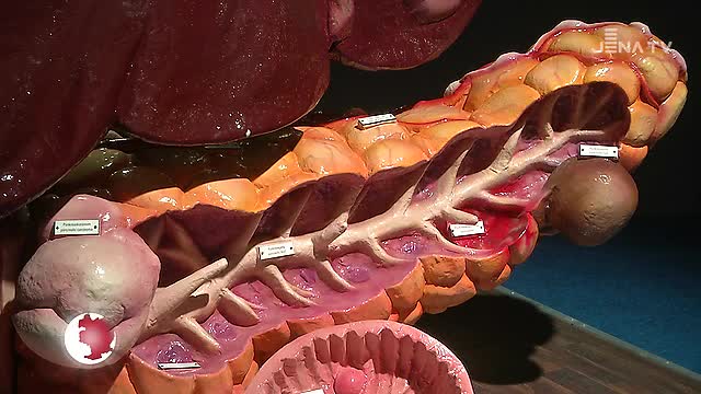 Information: Die Ausstellung „Organwelt“ in der Sparkassen-Arena bietet neue Perspektiven 