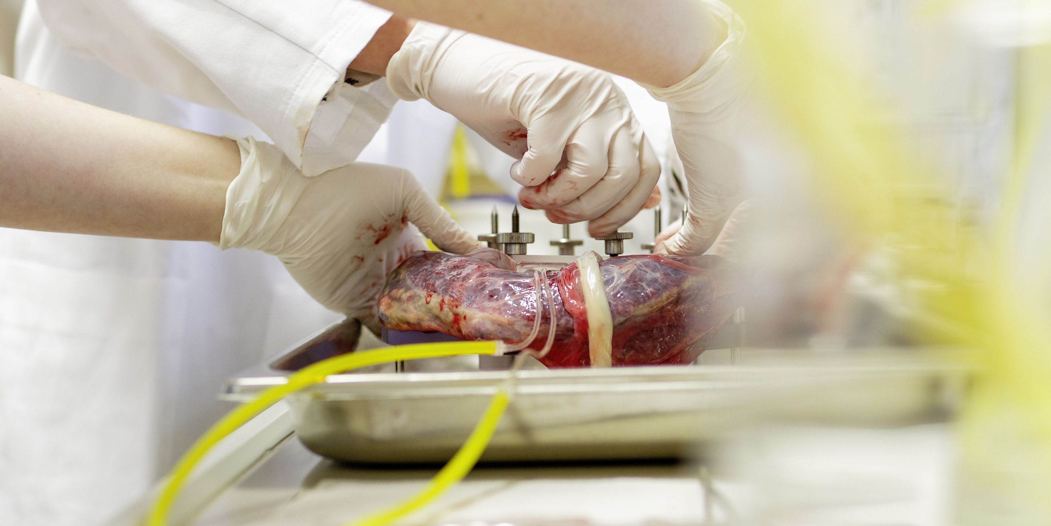 Mutterkuchen als Heilmittel? 