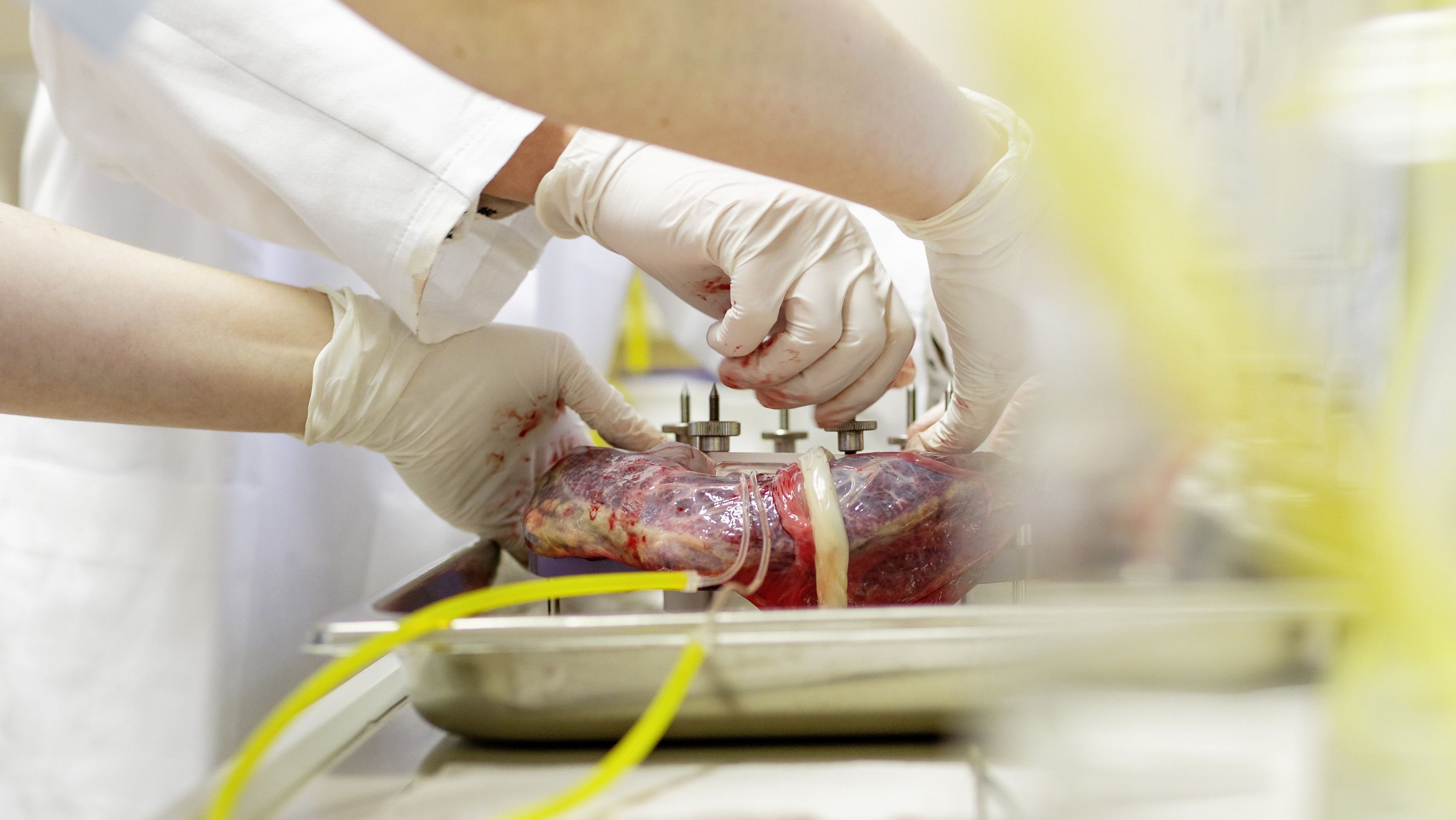 Mutterkuchen als Heilmittel? 