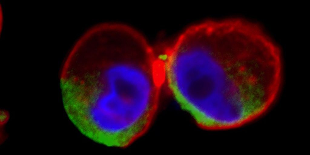 Körpereigenes Protein löst Entzündungsreaktion aus
