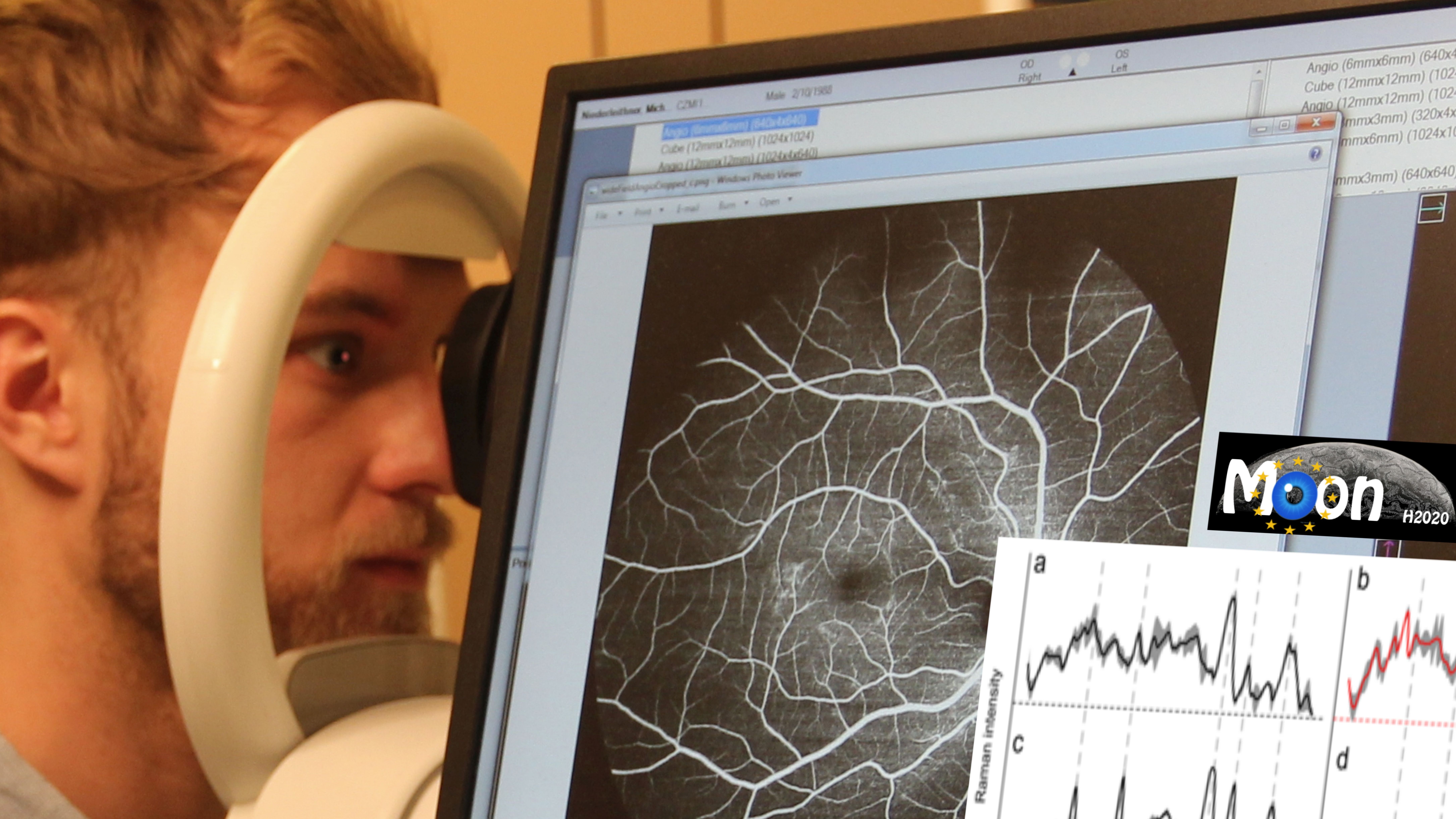 Augenscan macht Krankheiten frühzeitig sichtbar