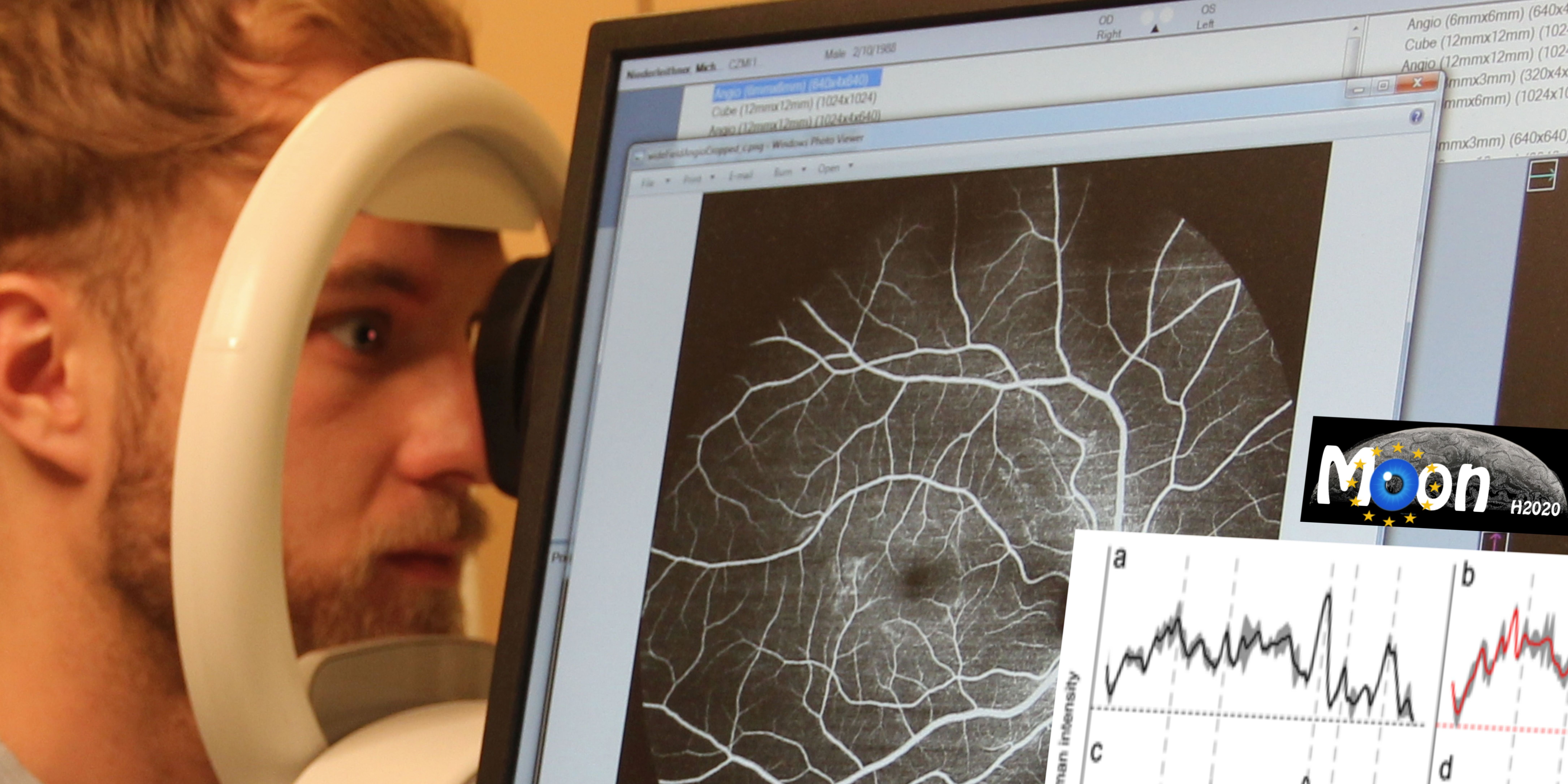 Augenscan macht Krankheiten frühzeitig sichtbar Augenscan macht Krankheiten frühzeitig sichtbar