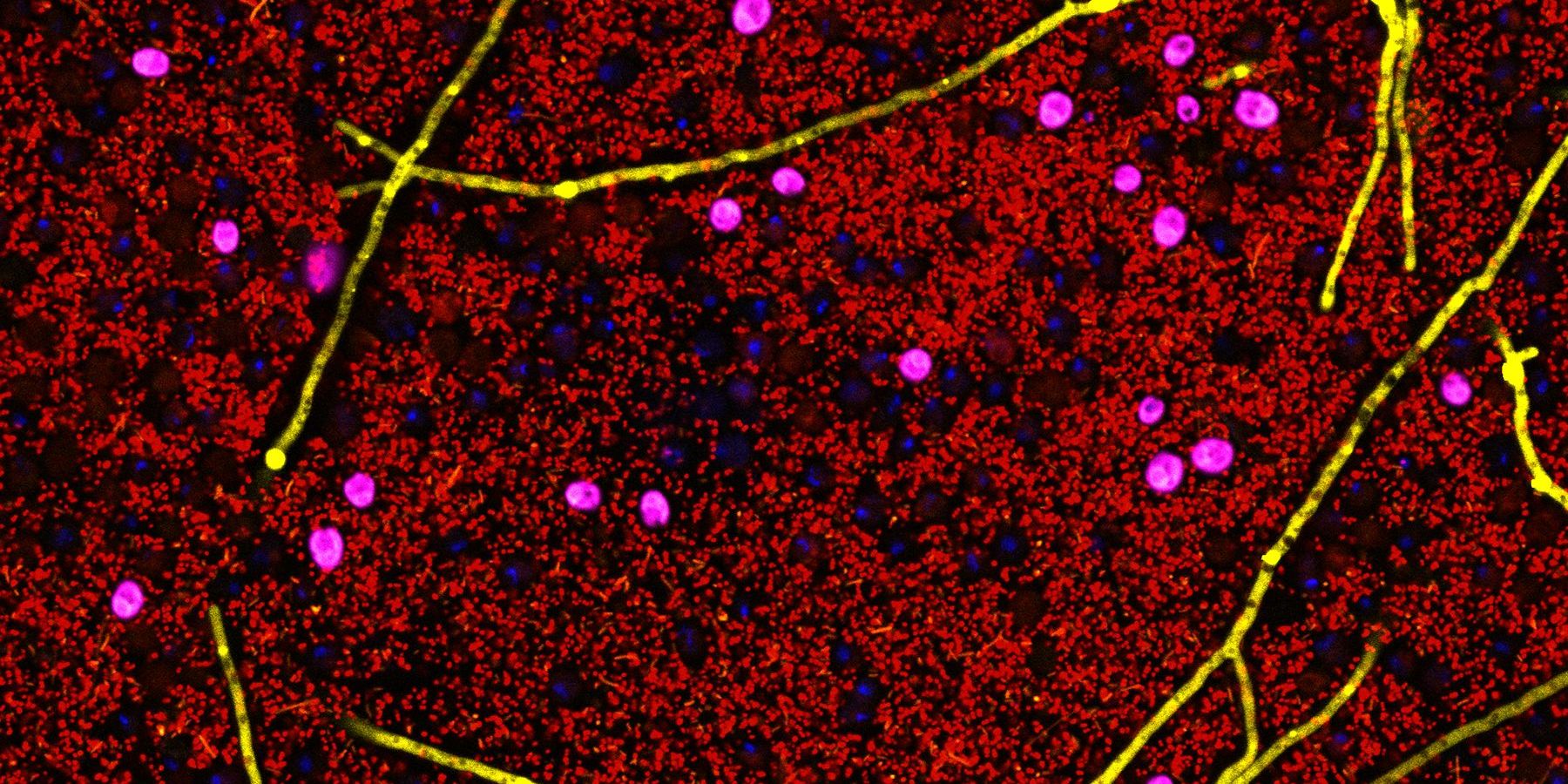 Bewegung schützt vor Diabetes – aber wie?