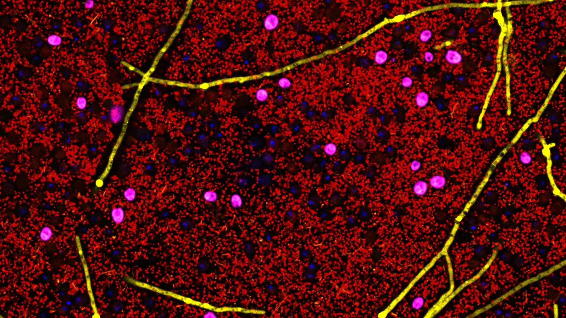 Bewegung schützt vor Diabetes – aber wie?