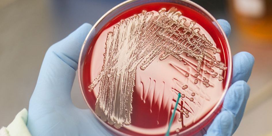 Superkeim vom indischen Subkontinent analysiert