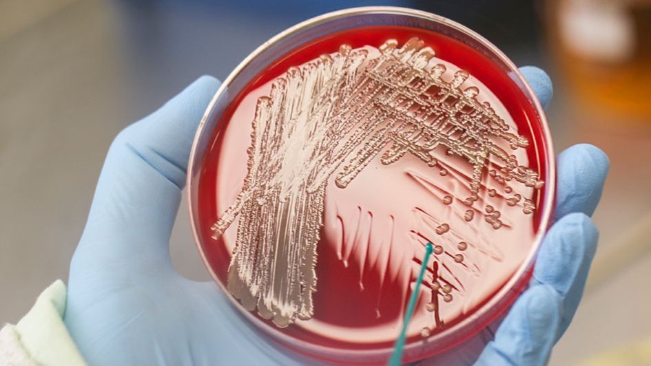 Superkeim vom indischen Subkontinent analysiert