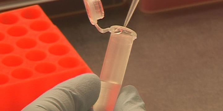 Immunkollaps nach einer Sepsis