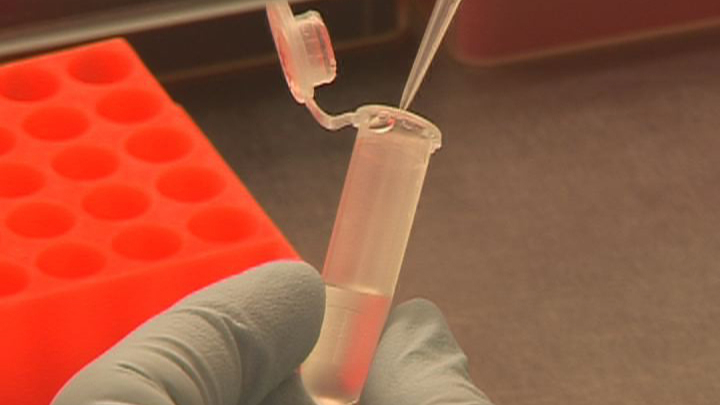 Immunkollaps nach einer Sepsis