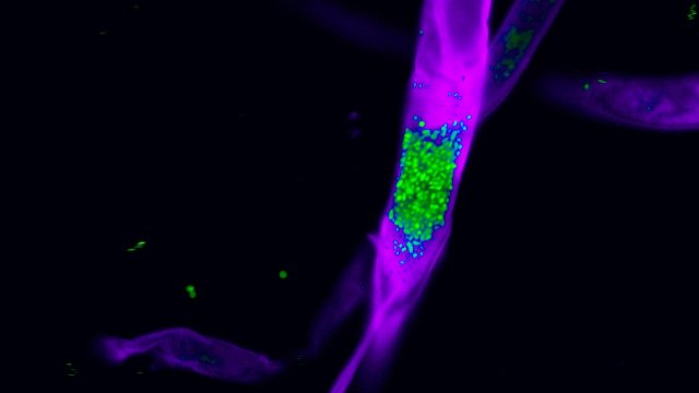 Spinnenbiss führt zu neuen Wirkstoffen