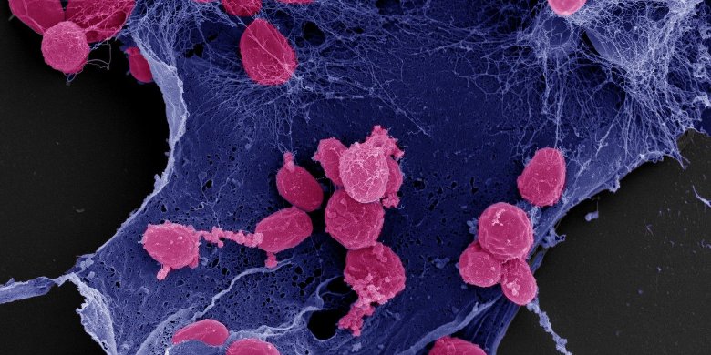 Wasserbakterien haben einen grünen Daumen