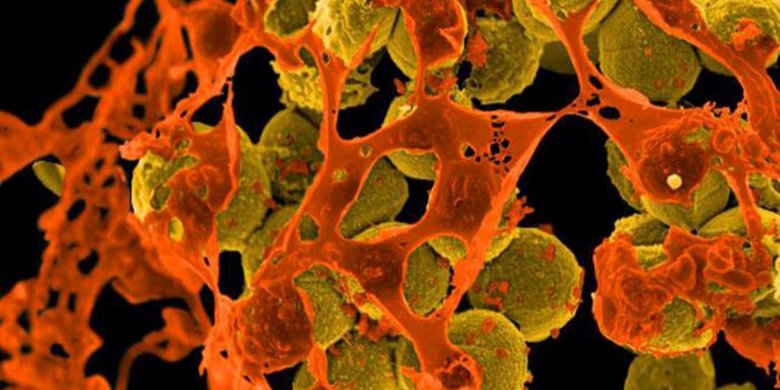 Neuer Bakterienstamm wird von Tests nicht erkannt