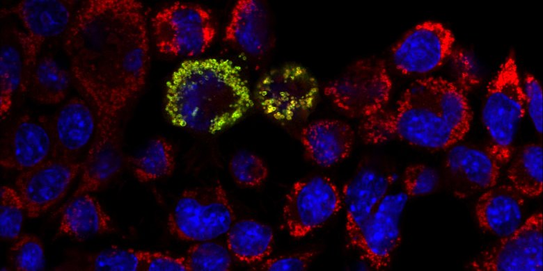 Gendefekt neu entdeckt