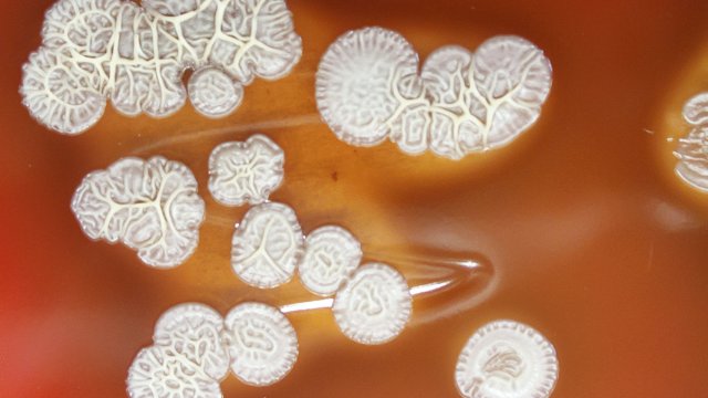 Schnelltest auf Tropenkrankheit entwickelt