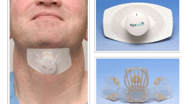 HNO-Uniklinik testet neues Zungenschrittmachersystem 