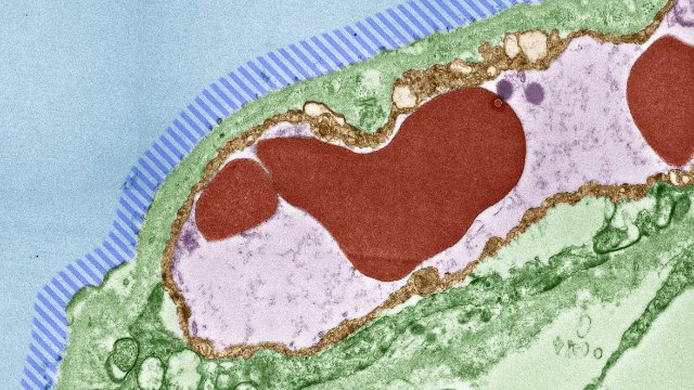 COVID-19-Atlas der Gewebeschäden und Viruslast in Organen