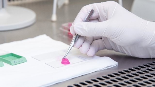 3D-Hautinfektionsmodell ersetzt Tierversuche