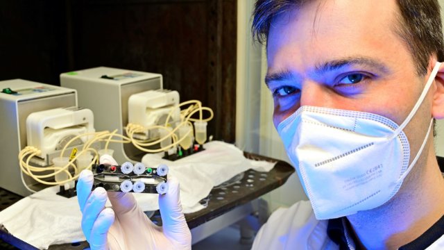 Forschung zu chronisch entzündlichen Darmerkrankungen 