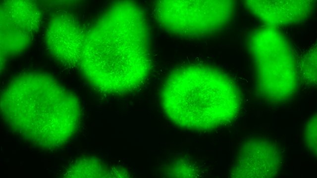 Bakterien produzieren Signalmoleküle