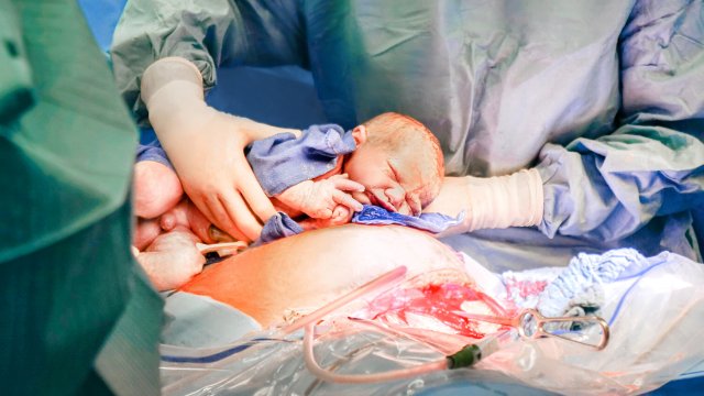 Studie fordert bessere Schmerzversorgung nach einem Kaiserschnitt