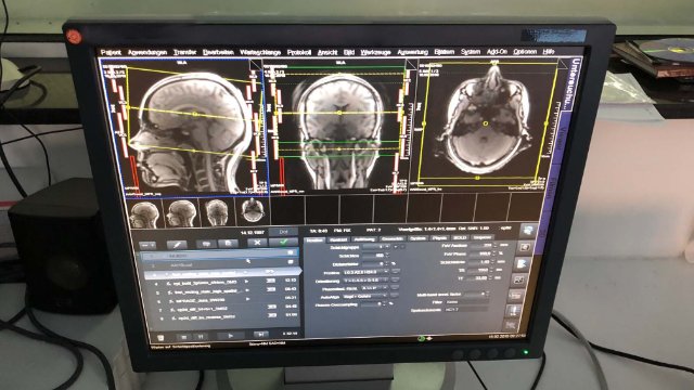 Warum Fernsehen besser ist als sein Ruf