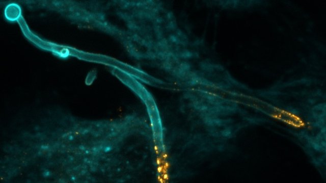 Mit Nanokörpern gegen Scheidenpilz