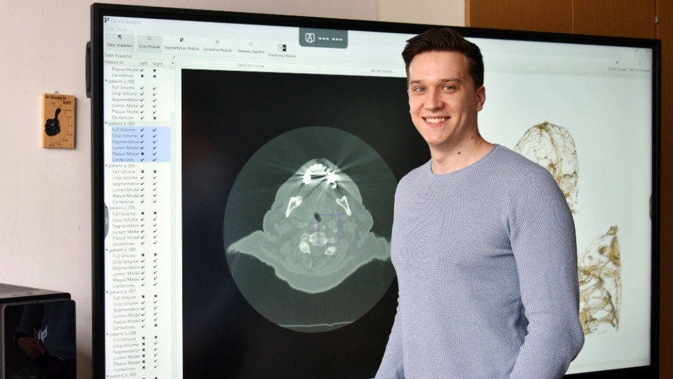 Verengungen der Halsschlagader sichtbar machen