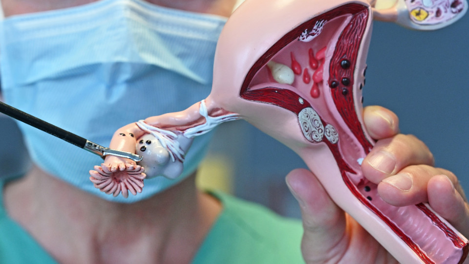 Vorsorgliche Eileiterentfernung 