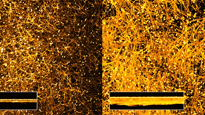 Forscher entdecken unbekannte Infektionsstrategie