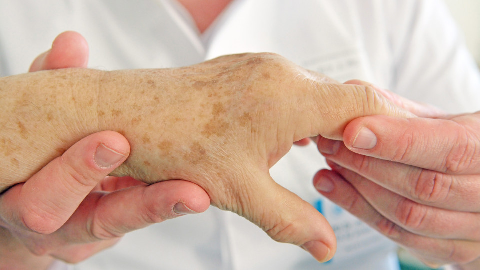 UKJ lädt zum „RheumaDialog Jena“