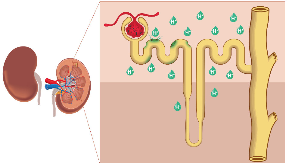 Neue Erkenntnisse aus Jena zu seltenem Nierenleiden
