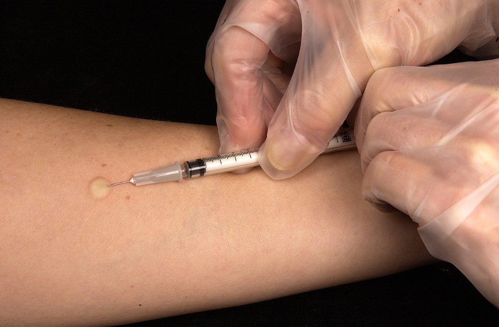 Bislang 559 Anträge wegen Corona-Impfschäden gestellt